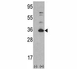 Western blot analysis of CDK4 antibody and 293 cell lysate (2 ug/lane) either nontransfected (Lane 1) or transiently transfected with the CDK4 gene (2).