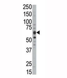 Western blot analysis of DYRKB antibody and mouse kidney tissue lysate. Predicted molecular weight :64-75 kDa (isoforms 1-3).