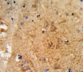 IHC analysis of FFPE human brain tissue stained with PCSK2 antibody