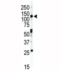 Western blot analysis of EphB2 antibody and NCI-H460 cell lysate.