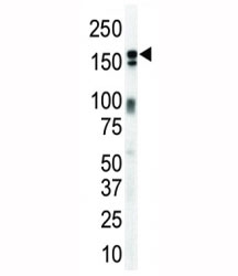 HER3 Antibody Mouse Brain WB. Western blot analysis of mouse brain lysate using HER3 Antibody / ERBB3 Tumor Signaling Antibody detects a band at approximately 150â180 kDa, consistent with the predicted molecular weight of HER3 / ERBB3, which may appear as a broad band due to glycosylation.