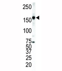 ERBB4 Antibody WB. Western blot analysis of ERBB4 antibody in T47D cell lysate. Protein lysates from human T47D breast carcinoma cells were resolved by SDS-PAGE under reducing conditions and probed with ERBB4 antibody. A prominent immunoreactive band is detected at approximately 150-160 kDa, consistent with the predicted molecular weight of the full-length HER4 precursor (147-180 kDa). Possible additional lower molecular weight bands at approximately 120 kDa and 80 kDa may represent proteolytically cleaved forms of ERBB4 generated through regulated intramembrane processing. The observed banding pattern aligns with known HER4 receptor processing and cleavage dynamics.