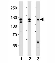 Western blot analysis of lysate from (1) HeLa, (2) K562 and (3) MCF-7 cell line using FGFR2 antibody at 1:1000. Predicted molecular weight: 80-120 kDa. The observed size may be larger due to glycosylation.