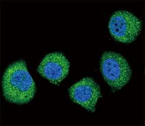 Confocal immunofluorescent analysis of FGFR2 antibody with U251 cells followed by Alexa Fluor 488-conjugated goat anti-rabbit lgG (green). DAPI was used as a nuclear counterstain (blue).