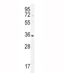 IGFBP3 antibody western blot analysis in CHO tissue lysate. The glycoprotein is visualized between 31~44 kDa.