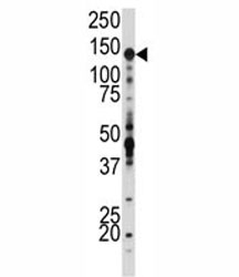Western blot analysis of IGF1R antibody and SK-BR-3 lysate. Predicted molecular weight: ~200 kDa (pro), 120-130 kDa (alpha), 90-97 kDa (beta).