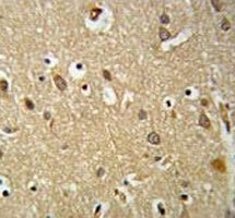 IGF1R antibody IHC analysis in formalin fixed and paraffin embedded brain tissue.