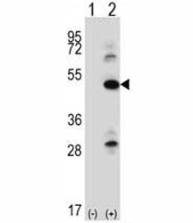 Western blot analysis of ILK antibody and 293 cell lysate either nontransfected (Lane 1) or transiently transfected (2) with the ILK gene. Expected molecular weight: 51-59 kDa.