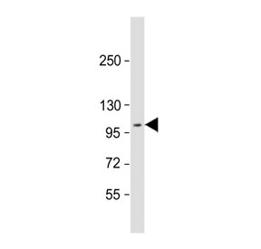 Western blot testing of human MCF7 cell lysate with DDR1 antibody. Predicted molecular weight: 100-125 kDa.