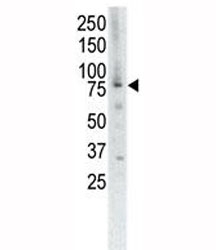 Western blot analysis of MUSK antibody and placenta cell lysate