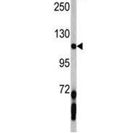 Western blot analysis of PDGFRA antibody and mouse lung tissue lysate. Expected molecular weight: 120-195 kDa.