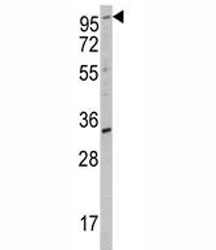 Western blot analysis of ROR2 antibody and K562 lysate.