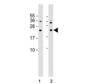 Western blot analysis of human 1) A431 and 2) HepG2 cell lysate with NRAS antibody. Predicted molecular weight ~21 kDa.