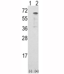 Western blot analysis of CAMKK1 antibody and 293 cell lysate either nontransfected (Lane 1) or transiently transfected with the CAMKK1 gene (2).