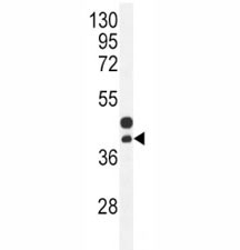 CTGF antibody western blot analysis in mouse bladder tissue lysate. Predicted molecular weight ~38 kDa.