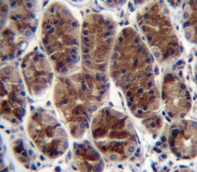 CTGF antibody immunohistochemistry analysis in formalin fixed and paraffin embedded human stomach tissue.