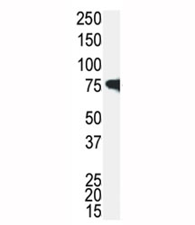 Western blot analysis of IRAK antibody and Jurkat cell lysate. Predicted molecular weight 68-76 kDa.