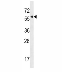 ALK2 antibody western blot analysis in U937 lysate