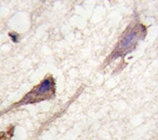 IHC analysis of FFPE human brain tissue stained with BRAF antibody