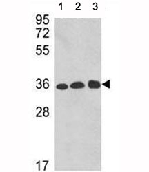 Western blot analysis of GAPDH antibody and 1) A2058, 2) A375, and 3) CEM lysate. Predicted molecular weight ~36kDa.