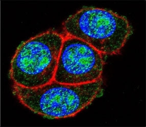 Confocal immunofluorescent analysis of GAPDH antibody with HeLa cells followed by Alexa Fluor 488-conjugated goat anti-rabbit lgG (green). Actin filaments have been labeled with Alexa Fluor 555 Phalloidin (red). DAPI was used as a nuclear counterstain (blue).