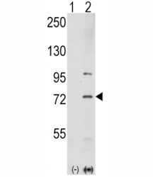 Western blot analysis of PAK1 antibody and 293 cell lysate either nontransfected (Lane 1) or transiently transfected with the PAK1 gene (2). Expected molecular weight 60~70kDa.