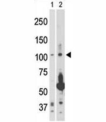 NIK antibody used in western blot to detect NIK in 293 cell lysate (Lane 1) and rat testis tissue lysate (2). Predicted molecular weight ~104 kDa.