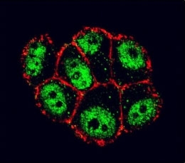 IkB alpha Antibody ZR-75-1 IF. Confocal immunofluorescent analysis of IkB alpha antibody with ZR-75-1 cells followed by Alexa Fluor 488-conjugated goat anti-rabbit lgG (green). Actin filaments have been labeled with Alexa Fluor 555 Phalloidin (red).