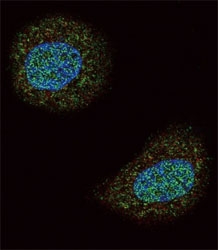 Confocal immunofluorescent analysis of PTEN antibody with MCF-7 cells followed by Alexa Fluor 488-conjugated goat anti-rabbit lgG (green). Actin filaments have been labeled with Alexa Fluor 555 Phalloidin (red). DAPI was used as a nuclear counterstain (blue).