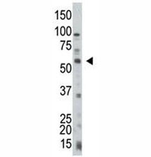 PTEN antibody used in western blot to detect PTEN in HL-60 cell lysate