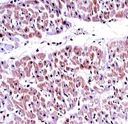 PTEN antibody immunohistochemistry analysis in formalin fixed and paraffin embedded human heart tissue.