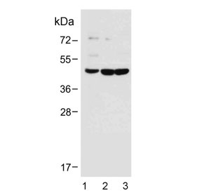 DUSP6 Antibody Brain Tissue Western Blot. Western blot analysis of human brain (lane 1), mouse brain (lane 2), and rat brain (lane 3) tissue lysates using DUSP6 antibody demonstrates distinct bands at approximately 42 kDa, consistent with the expected molecular weight of DUSP6 isoform 1. DUSP6 (Dual Specificity Phosphatase 6) is a key negative regulator of ERK/MAPK signaling pathways, functioning to dephosphorylate activated ERK proteins and modulate downstream signal transduction. By regulating signaling intensity and duration, DUSP6 influences pathways involved in cellular differentiation, survival, growth factor responses, and tissue homeostasis. Detection across human, mouse, and rat brain tissues supports the conserved role of DUSP6 in maintaining MAPK signaling balance within the nervous system. Predicted molecular weights for DUSP6 isoforms are approximately 42 kDa and 26 kDa.