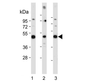DUSP6 Antibody Human and Brain Tissue Western Blot. Western blot analysis of human HepG2 cells (lane 1), human brain tissue (lane 2), and rat brain tissue (lane 3) using DUSP6 antibody demonstrates distinct bands at approximately 42-45 kDa, consistent with the expected molecular weight of DUSP6 isoform 1. DUSP6 (Dual Specificity Phosphatase 6) is a key negative regulator of ERK/MAPK signaling pathways, functioning to dephosphorylate activated ERK proteins and thereby modulate signal transduction, growth factor responses, cellular differentiation, and tissue homeostasis. Detection of DUSP6 in both hepatic and neural tissues supports its broad role in maintaining MAPK signaling balance across diverse biologic systems. Predicted molecular weights for DUSP6 isoforms are approximately 42 kDa and 26 kDa.
