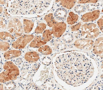 DUSP6 Antibody Human Kidney IHC. Immunohistochemical staining of FFPE human kidney tissue using DUSP6 antibody demonstrates strong cytoplasmic HRP-DAB brown staining within renal tubular epithelial cells, with comparatively weaker staining in surrounding stromal and glomerular structures. The staining pattern is consistent with expression of DUSP6 (Dual Specificity Phosphatase 6), a key negative regulator of ERK/MAPK signaling pathways. By dephosphorylating activated ERK proteins, DUSP6 helps modulate intracellular signaling responses involved in cellular differentiation, survival, growth factor signaling, and tissue homeostasis. The prominent tubular epithelial staining supports the role of DUSP6 in maintaining regulated MAPK pathway activity within metabolically active epithelial tissues. HIER: steam section in pH 9 EDTA for 20 minutes and allow to cool prior to staining.