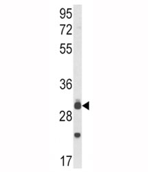 Western blot analysis of MyD88 antibody and mouse lung tissue lysate. Predicted molecular weight: 33 kDa