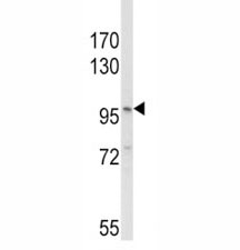 NLRP3 Antibody MDA-MB-231 WB. Western blot analysis of NLRP3 antibody and MDA-MB-231 lysate. Predicted molecular weight ~118 kDa.