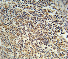 NLRP3 Antibody Lymph Tissue IHC. NLRP3 antibody immunohistochemistry analysis in formalin fixed and paraffin embedded human lymph tissue.