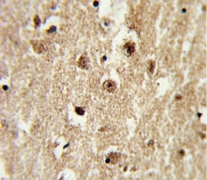 IHC analysis of FFPE human brain tissue with IGFBP2 antibody