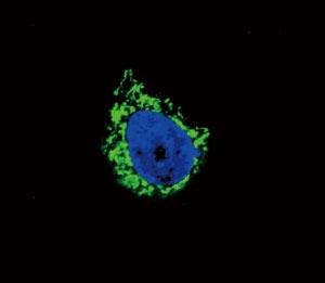 Confocal immunofluorescent analysis of IGFBP2 antibody with A549 cells followed by Alexa Fluor 488-conjugated goat anti-rabbit lgG (green). DAPI was used as a nuclear counterstain (blue).