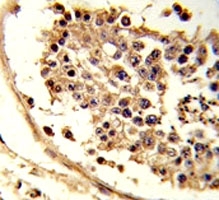 IHC analysis of FFPE human testis tissue stained with CXCR7 antibody