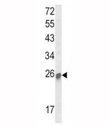 Western blot analysis of SOCS1 antibody and mouse kidney tissue lysate. Predicted molecular weight ~ 24 kDa.