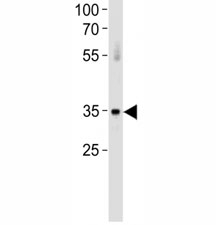ATF7 antibody western blot analysis in huamn placenta tissue lysate. Predicted molecular weight: isoforms of ~53/51/34/13kDa may be detected.