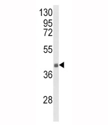 Western blot analysis of HLA-G antibody and NCI-H460 lysate. Predicted molecular weight ~40 kDa.
