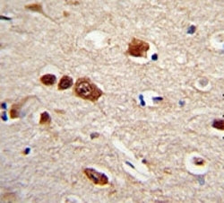 IHC analysis of FFPE human brain tissue stained with HuR antibody