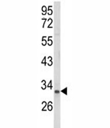 Western blot analysis of NKX3.1 antibody and MCF-7 lysate. Predicted molecular weight ~28 kDa, observed at 28-38 kDa.
