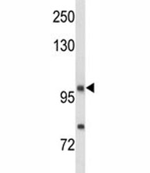 Western blot analysis of NRP1 antibody and MDA-MB435 lysate