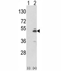 Western blot analysis of PKM2 antibody and 293 cell lysate (2 ug/lane) either nontransfected (Lane 1) or transiently transfected with the PKM2 gene (2). Predicted molecular weight ~58 KDa.