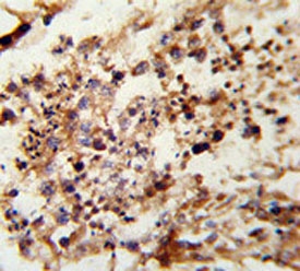 IHC analysis of FFPE human testis tissue stained with Acrosin antibody