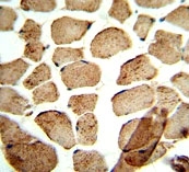 IHC analysis of FFPE human skeletal muscle stained with ULK1 antibody