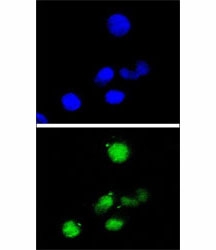 Confocal immunofluorescent analysis of p21 antibody with HepG2 cells followed by Alexa Fluor 488-conjugated goat anti-rabbit lgG (green). DAPI was used as a nuclear counterstain (blue).
